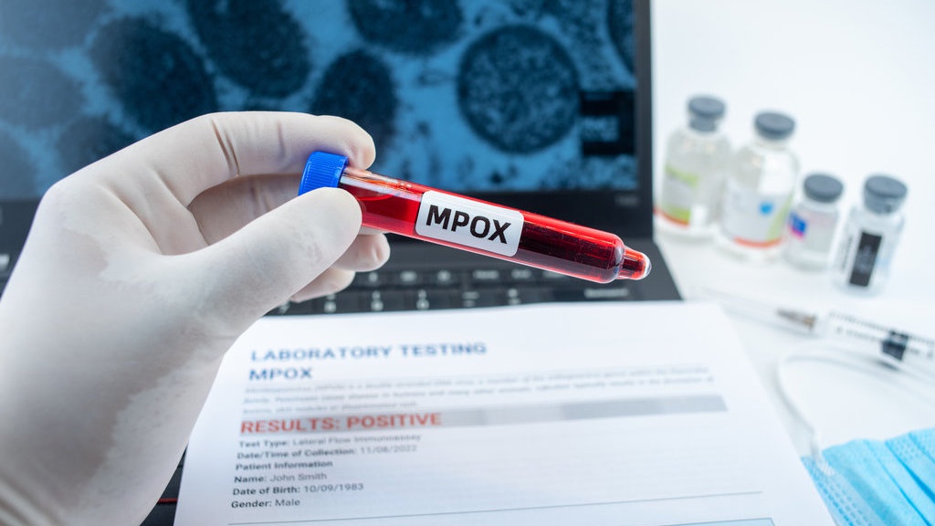 Semua yang Perlu Anda Ketahui tentang Cacar Monyet di Indonesia