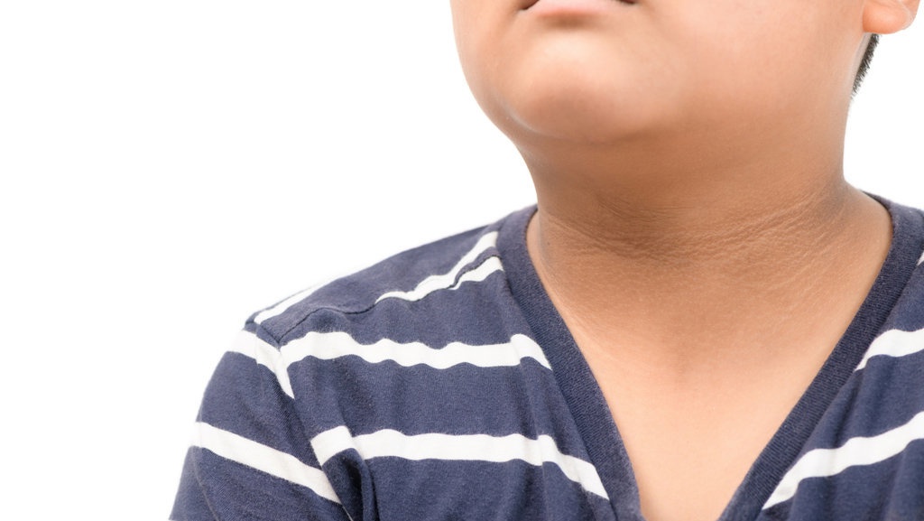 7 Rekomendasi Obat Leher Hitam di Apotik untuk Eksfoliasi