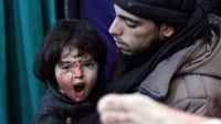 Rumah Sakit Suriah Diserang, 10 Tewas Puluhan Luka-luka