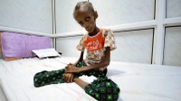 Jutaan Warga Yaman Hadapi Krisis Pangan Saat Ramadan