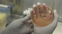 WHO Rilis Daftar 12 Bakteri yang Resistan Antibiotik