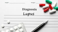 Lupus, Penyakit Autoimun, Apa Penyebab dan Gejalanya?