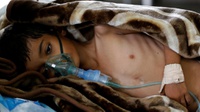 WHO Berupaya Atasi Lonjakan Penularan Kolera di Yaman