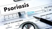 Mengenal Penyakit Psoriasis pada Anak, Gejala dan Penyebabnya