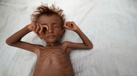 Blokade Saudi Memperparah Bencana Kelaparan di Yaman 