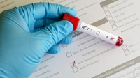Apa Itu Penyakit Hepatitis Akut, 9 Gejala dan 5 Tips Mencegahnya