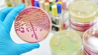Apa Itu Superbug Kebal Antibiotik: Dampak, Penyebab, dan Risiko