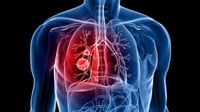 14 Jenis Penyakit Sistem Pernapasan: Asma, Asidosis, hingga TBC