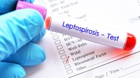 Kemenkes: Waspada Penyakit Leptospirosis saat Musim Hujan