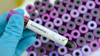 Peningkatan Kasus Virus Corona di Singapura dan Imbauan KBRI ke WNI