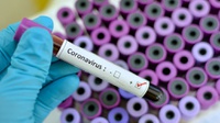 Gejala Virus Corona COVID-19 Bertambah, Ada Pasien dengan Lesi Kaki