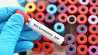 Mengapa Perokok Disebut Lebih Rentan Terpapar Virus Corona?