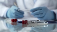 WHO: Muncul Kasus Strain Sudan, Uganda Umumkan KLB Ebola