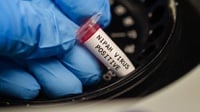 Virus Nipah Potensial Jadi Pandemi, Bagaimana Antisipasinya?