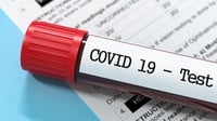 Update COVID-19 RI 4 Agustus 2022: Positif Tembus 6.527 Kasus
