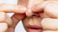 Cara Menghilangkan Komedo di Hidung dan Tips Pencegahannya