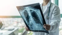 Kemenkes: Kecil Peluang Pneumonia Jadi Pandemi di Indonesia