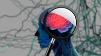 Alzheimer & Demensia: Perbedaan, Gejala, Mitos, dan Fakta-Faktanya
