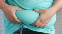 Fajri, Pasien Obesitas Berbobot 300 Kg Meninggal di RSCM