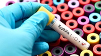 Bagaimana Cara Mengobati Penyakit Sifilis dan Apa Gejalanya?
