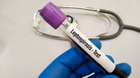 Leptospirosis Apakah Bisa Sembuh & Bagaimana Perawatannya?