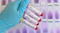 Info Tes HIV dan Layanan ARV Semarang Malam Hari Februari 2023