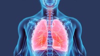 Cara Memperingati Hari Kanker Paru-paru Sedunia 1 Agustus 2023