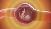 Apa Itu Kehamilan Ektopik yang Viral di Medsos, Bahaya, Penyebab