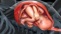 Penjelasan Medis Posisi Bayi Sungsang, Ciri-ciri hingga Penyebab