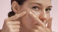 Kenapa Jerawat Susah Hilang padahal Sudah Pakai Skincare?