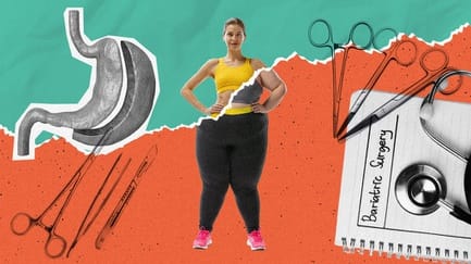 Bedah Bariatrik sebagai Alternatif Lain Melawan Obesitas