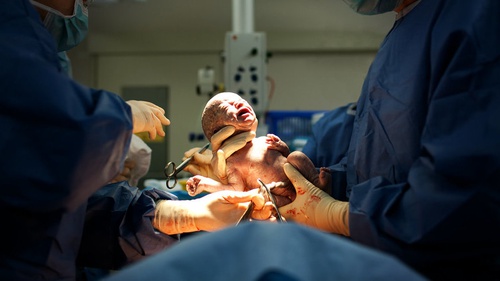 Risiko Nyawa: Nakes Pedalaman Khawatir Caesar oleh Dokter Umum