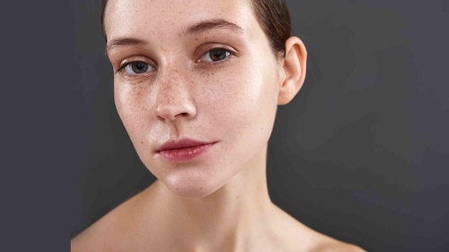 7 Cara Menghilangkan Freckles di Wajah dan Kenali Penyebabnya