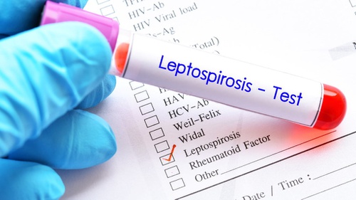 Ciri-Ciri Leptospirosis, Sebabkan Pasien Meninggal di Solo?