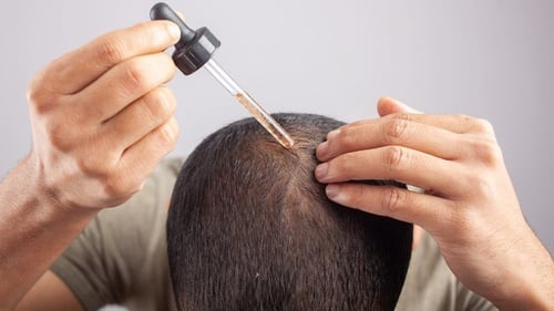 Manfaat Minoxidil untuk Rambut, Cara Pakai, dan Efek Sampingnya