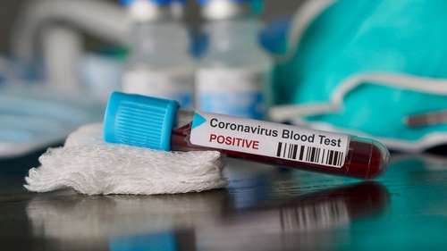 Apa Itu Rapid Test Coronavirus Deteksi Cepat Covid 19 Di Indonesia
