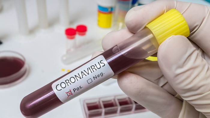  "Ciri-Ciri Corona & Gejala COVID-19, Apa Beda dari Flu & Pneumonia ?
