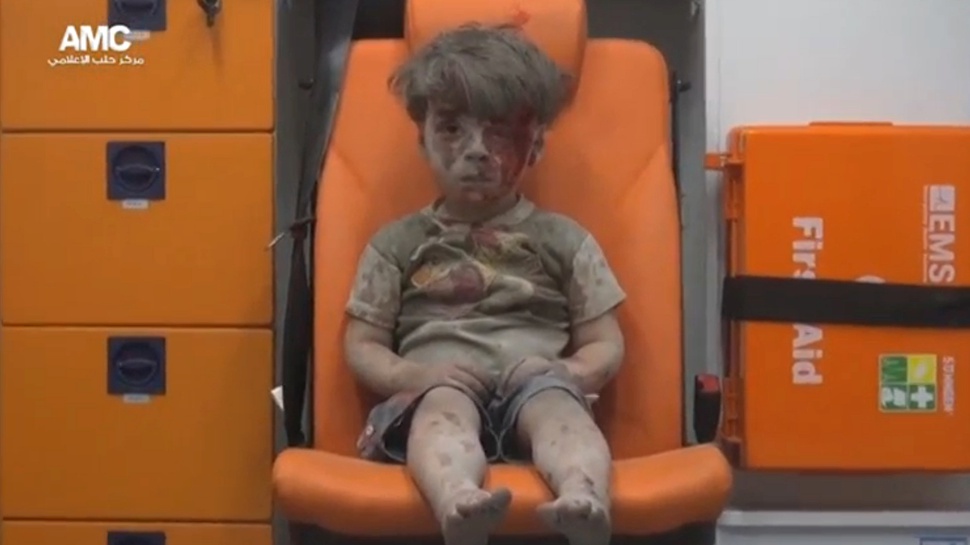 Bocah Selamat dari Serangan Udara di Suriah