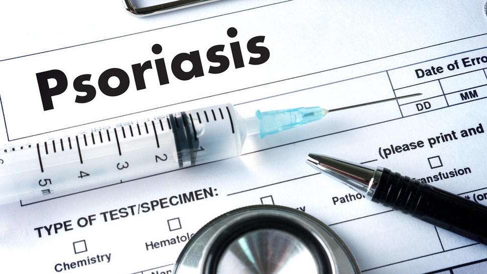 Mengenal Penyakit Psoriasis pada Anak, Gejala dan Penyebabnya