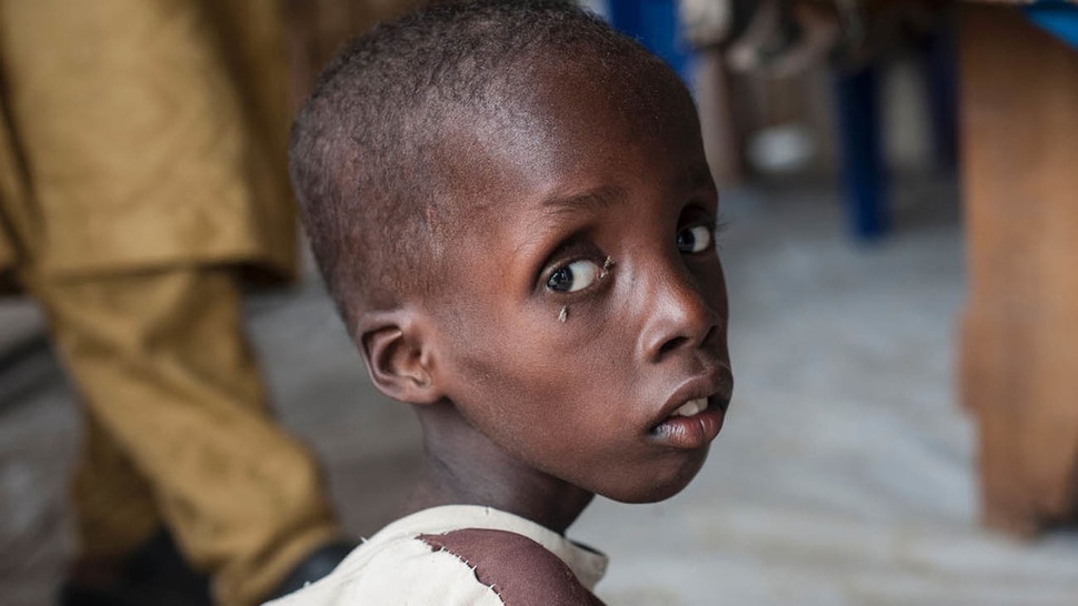Konflik Bersenjata di Afrika Picu Kelaparan Massal 