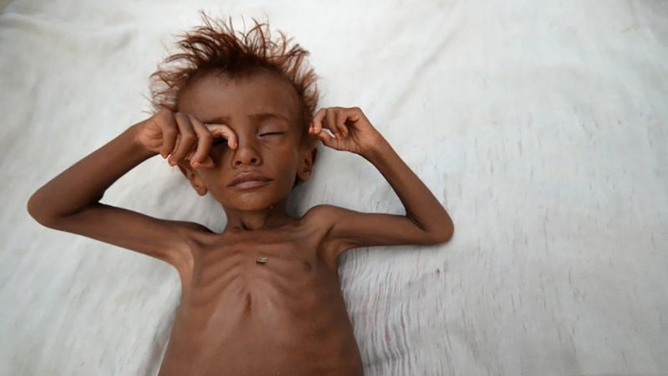 Blokade Saudi Memperparah Bencana Kelaparan di Yaman  