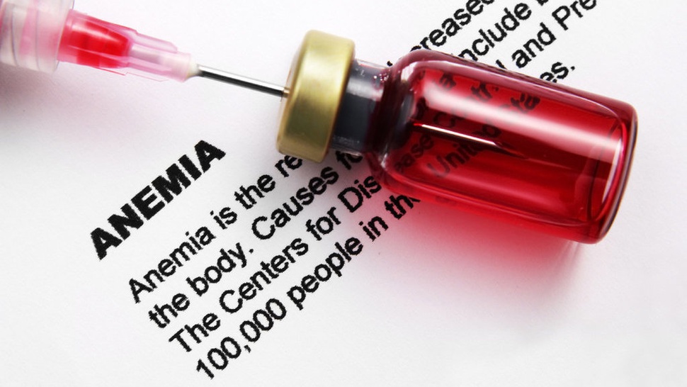 Tanda Anemia hingga Cara Mudah Mencegah Anemia