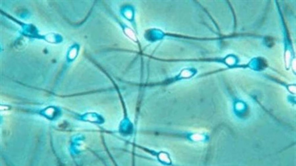 Bahan Kimia Rumah Tangga Bisa Sebabkan Penurunan Kualitas Sperma