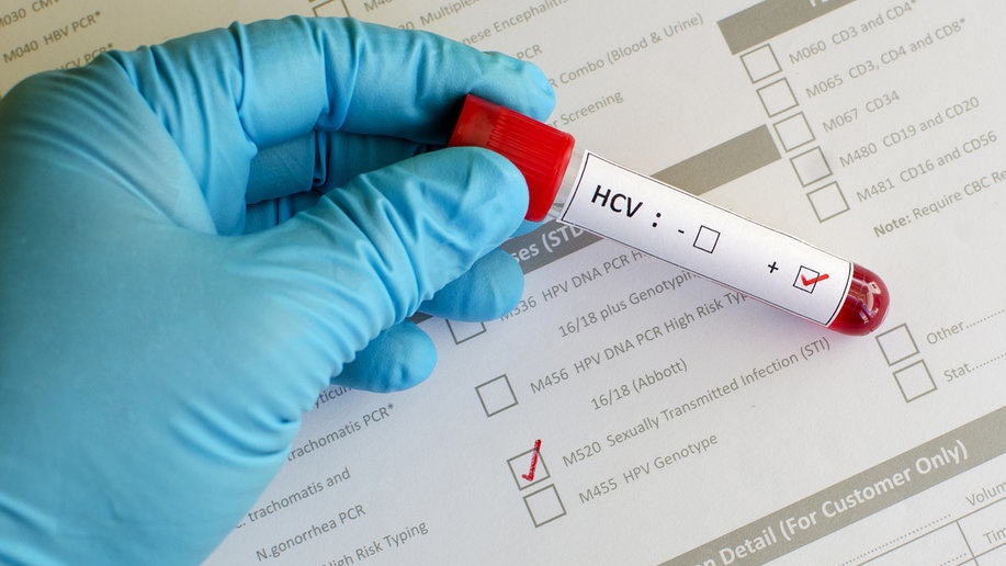 Respons Kemenkes soal WHO Nyatakan KLB Hepatitis Akut pada Anak