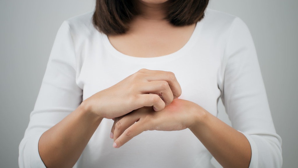 Mengenal Dermatitis Atopik dan Bagaimana Cara Mengatasinya