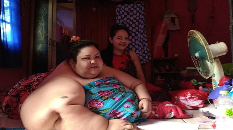 Operasi Bariatrik yang Dijalani Titi Wati untuk Atasi Obesitas