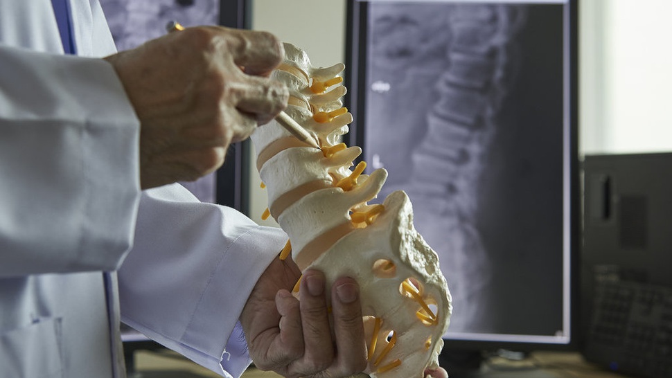Apa Itu Spinal Cord Injury dan Apakah Bisa Menyebabkan Kematian?