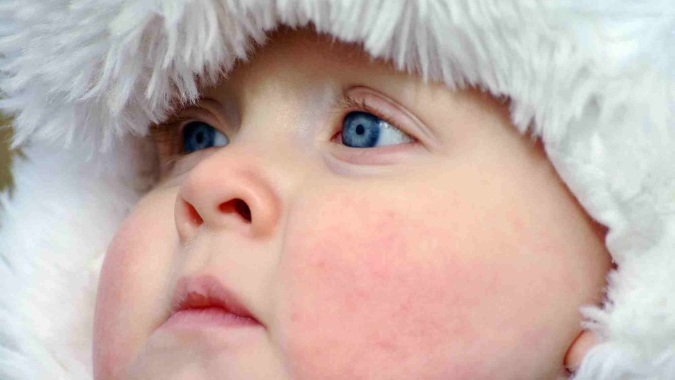 12 Cara Mencegah Ruam pada Lipatan Leher Bayi dan 7 Penyebabnya