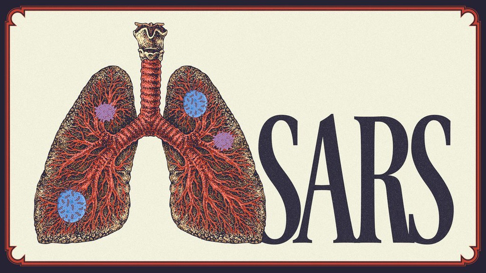 Sejarah Epidemi SARS: Bukti Wabah Virus yang Tak Pernah Berakhir