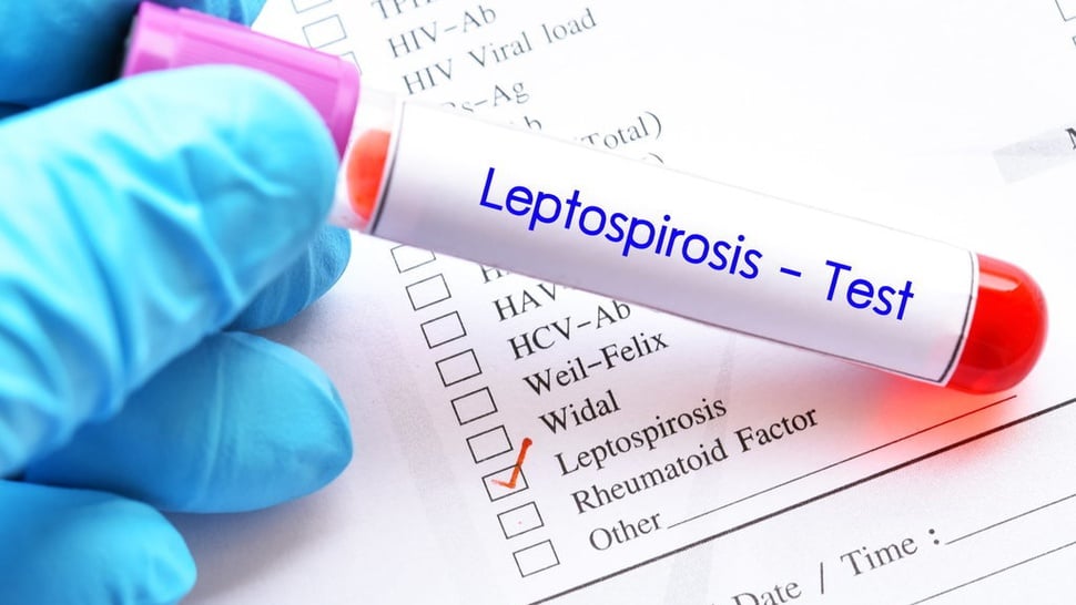 Penyakit Leptospirosis Menular Melalui Apa dan Cara Mencegahnya
